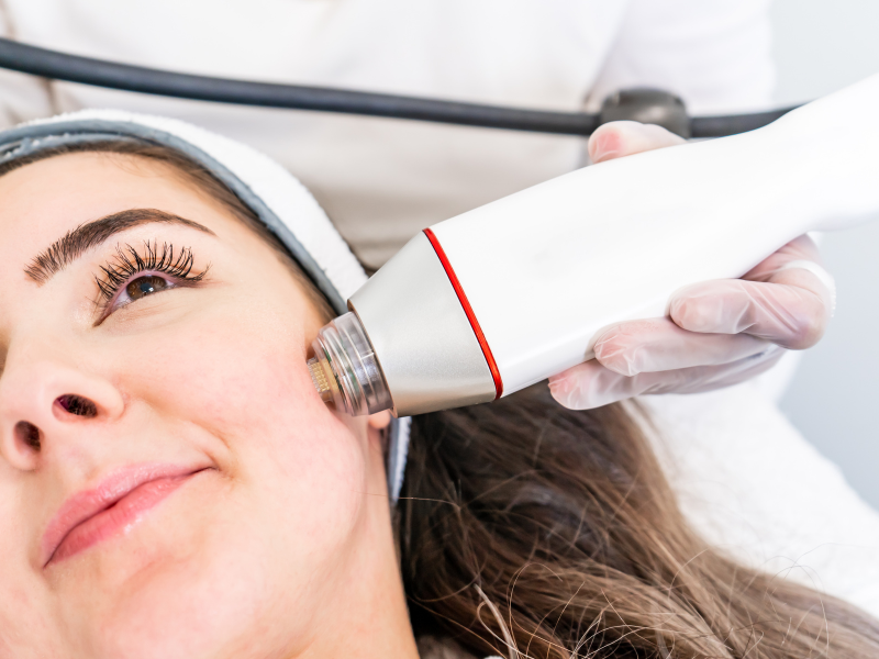 Targeting Sagging Skin with Radiofrequency Skin Tightening: An Effective Non-Surgical Solution