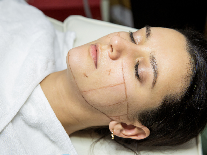 Understanding the Risks and Side Effects of Non-Invasive Face Lifts in Beverly Hills: Rejuvenate Your Appearance Safely