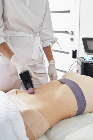 Navigating Radiofrequency Skin Tightening in Beverly Hills: Essential Questions for Professional Consultation