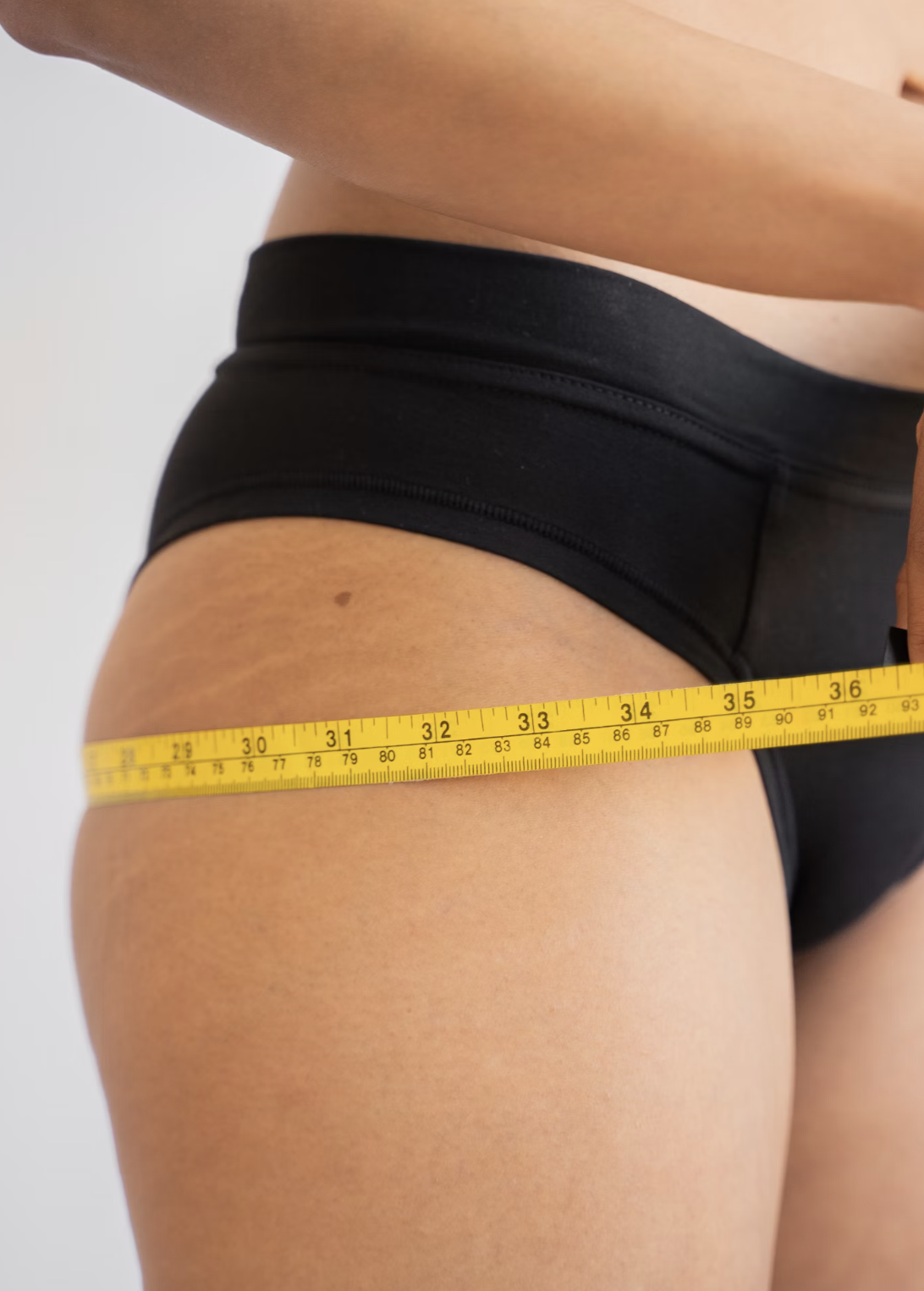 Skin Tightening After Weight Loss: Effective Strategies and Treatments